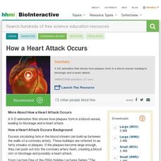How a Heart Attack Occurs Instructional Video How a Heart Attack Occurs Instructional Video