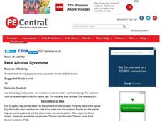 Fetal Alcohol Syndrome Lesson Plan Fetal Alcohol Syndrome Lesson Plan