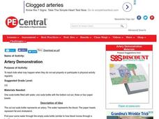 Artery Demonstration Lesson Plan Artery Demonstration Lesson Plan