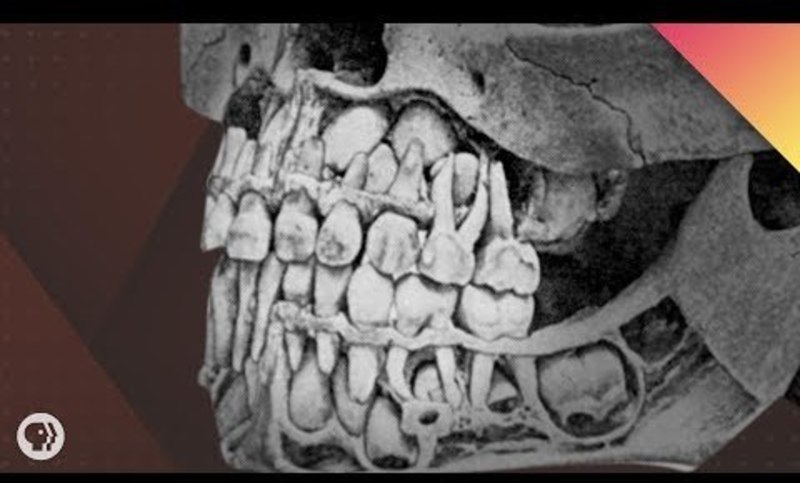 Where Do Teeth Come From? Video Where Do Teeth Come From? Video