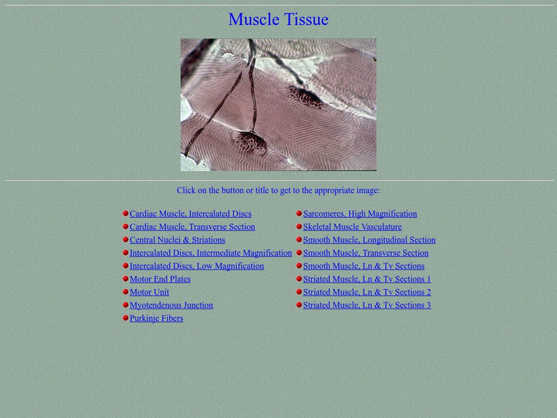 University of Delaware: Muscle Tissue Graphic University of Delaware: Muscle Tissue Graphic