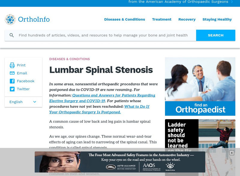 Aaos: Lumbar Spinal Stenosis Article Aaos: Lumbar Spinal Stenosis Article