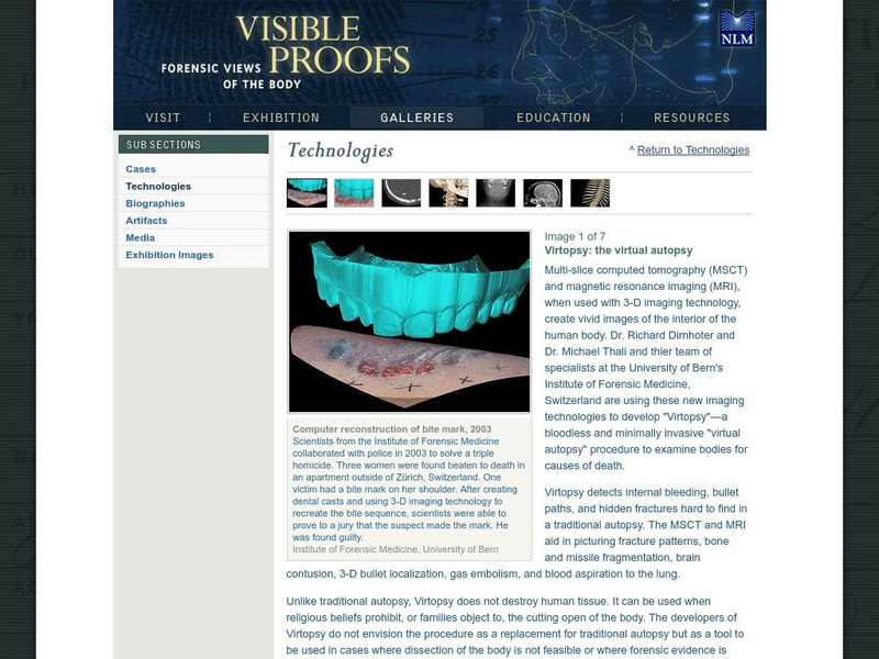 National Library of Medicine: Virtopsy, the Virtual Autopsy Unit Plan National Library of Medicine: Virtopsy, the Virtual Autopsy Unit Plan