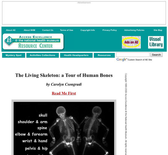 Access Excellence: The Living Skeleton: A Tour of Human Bones Graphic Access Excellence: The Living Skeleton: A Tour of Human Bones Graphic