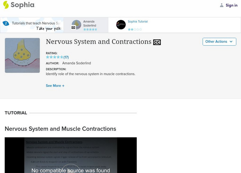 Sophia: Nervous System and Contractions: Lesson 1 Instructional Video Sophia: Nervous System and Contractions: Lesson 1 Instructional Video