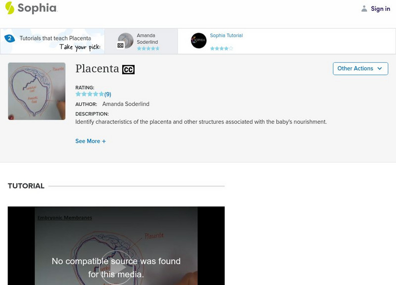 Sophia: Placenta: Lesson 2 Instructional Video Sophia: Placenta: Lesson 2 Instructional Video