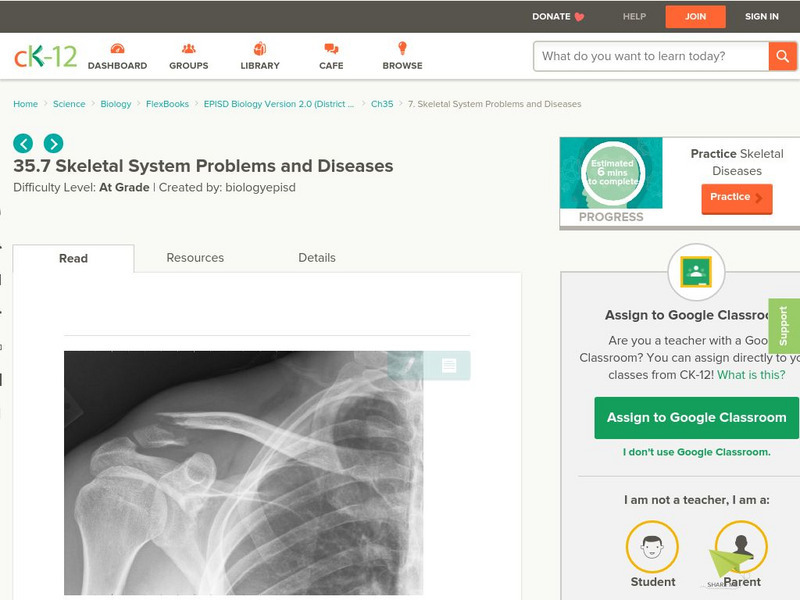 Ck 12: Episd: Skeletal System Problems and Diseases Unit Plan Ck 12: Episd: Skeletal System Problems and Diseases Unit Plan