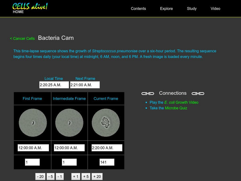 Cells Alive!: Bacteria Cam: Growth of Streptococcus Pneumoniae Interactive Cells Alive!: Bacteria Cam: Growth of Streptococcus Pneumoniae Interactive