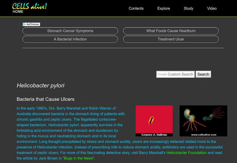 Cells Alive!: Helicobacter Pylori: Bacteria That Cause Ulcers Handout Cells Alive!: Helicobacter Pylori: Bacteria That Cause Ulcers Handout