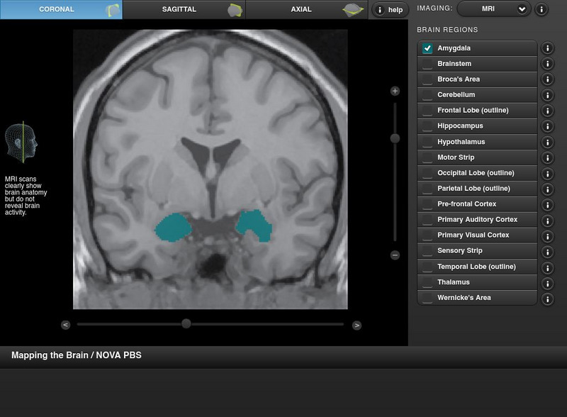 Pbs: Nova: Mapping the Brain Graphic Pbs: Nova: Mapping the Brain Graphic