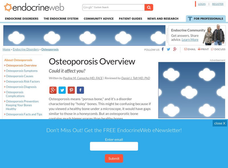Endocrine Web: Osteoporosis Center Website Endocrine Web: Osteoporosis Center Website