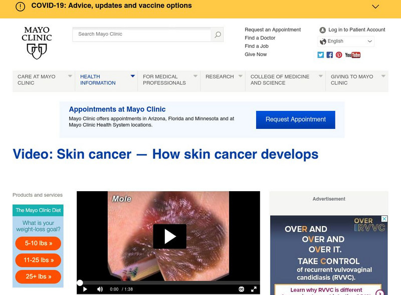 Mayo Clinic: Video: Melanoma: How Melanoma Develops and Spreads Instructional Video