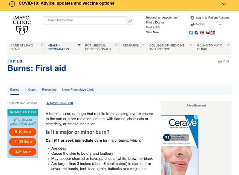 Mayo Clinic: Burns Website