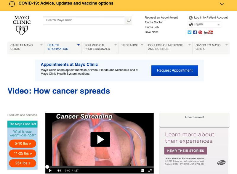 Mayo Clinic: Video: How Cancer Spreads Website Mayo Clinic: Video: How Cancer Spreads Website