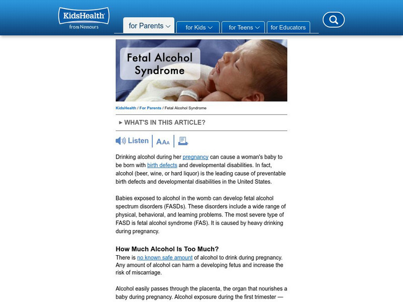 Kids Health: For Parents: Fetal Alcohol Syndrome Article Kids Health: For Parents: Fetal Alcohol Syndrome Article