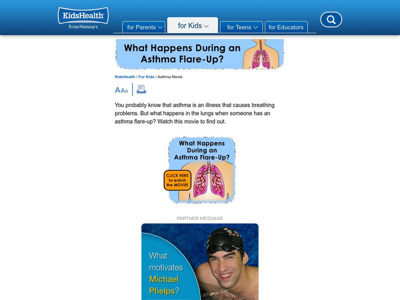 Kids Health: What Happens During an Asthma Flare Up? Instructional Video Kids Health: What Happens During an Asthma Flare Up? Instructional Video