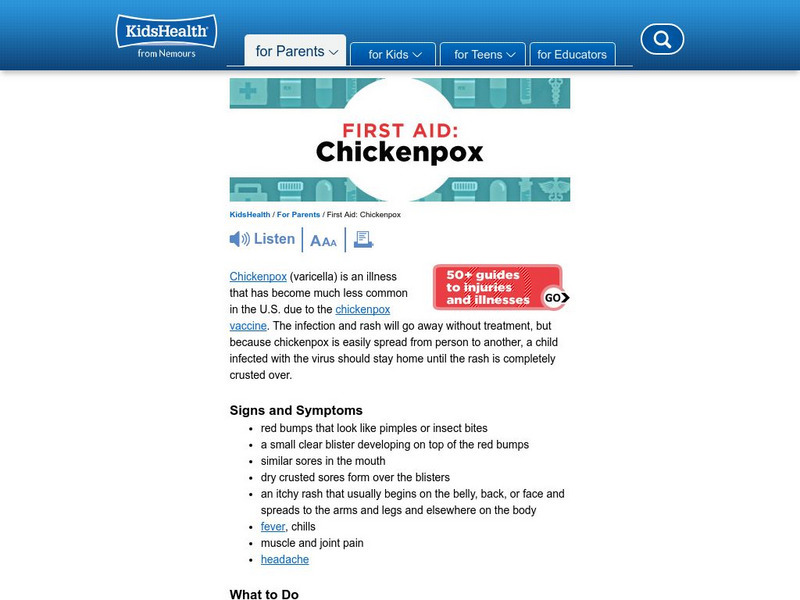 Kids Health: Chicken Pox Instruction Sheet Handout Kids Health: Chicken Pox Instruction Sheet Handout