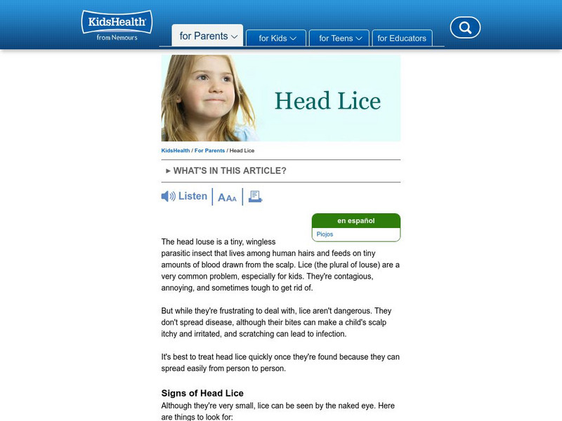 Kids Health: Head Lice Website Kids Health: Head Lice Website