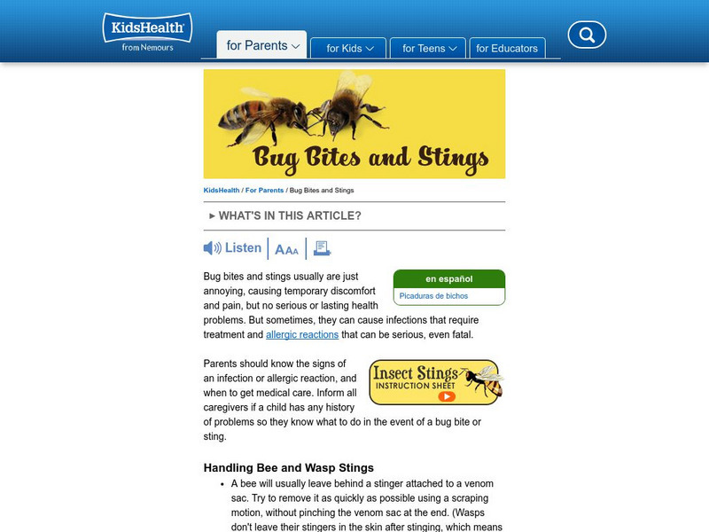 Kids Health: Insect Stings and Bites Article