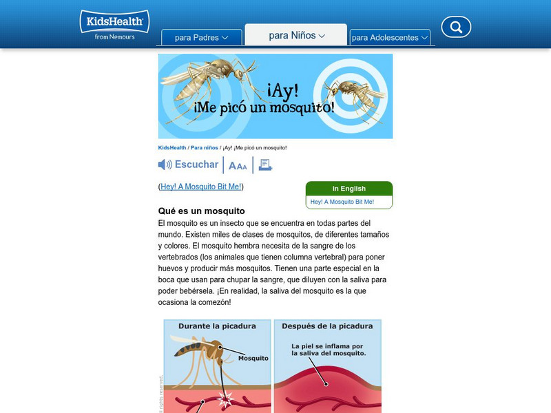 Kids Health: Ay! Me Pico Un Mosquito! Article