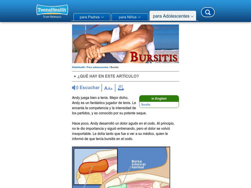 Kids Health: Bursitis Handout