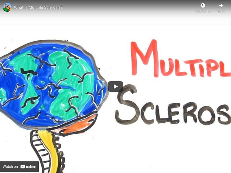 Asap Science: Multiple Sclerosis Instructional Video