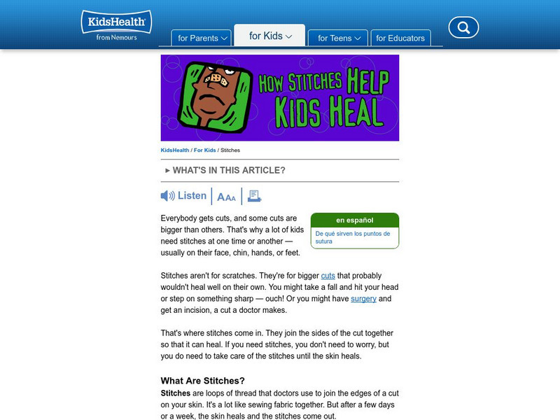 Kids Health: How Stitches Help Kids Heal Handout Kids Health: How Stitches Help Kids Heal Handout