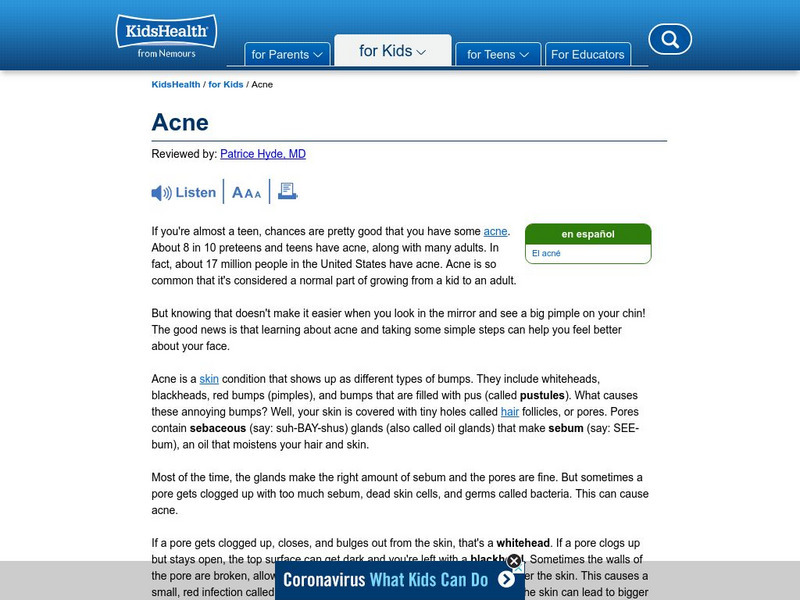 Kids Health: Acne Handout