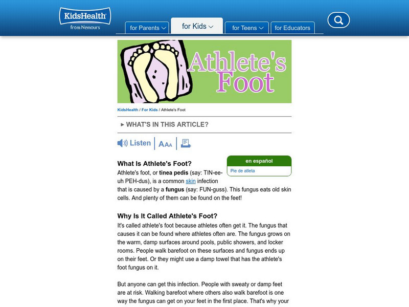 Kids Health: Athlete's Foot Handout Kids Health: Athlete's Foot Handout