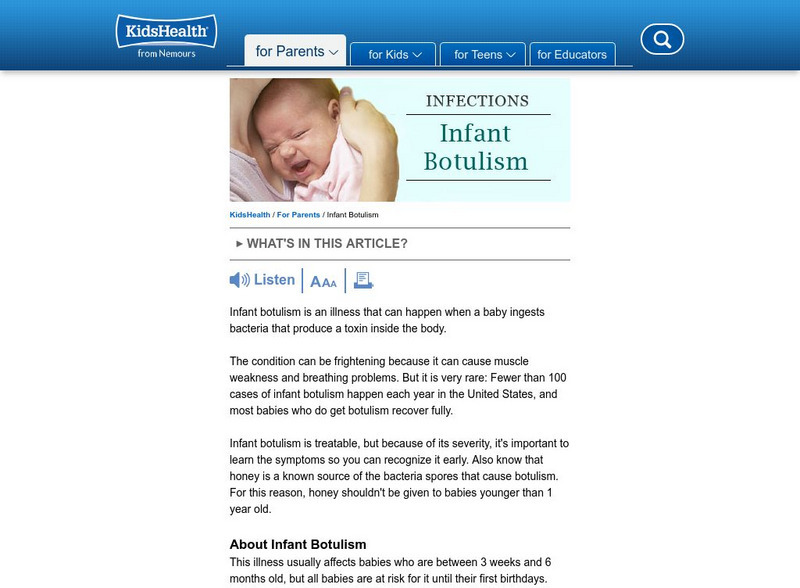 Kids Health: Infant Botulism Handout Kids Health: Infant Botulism Handout