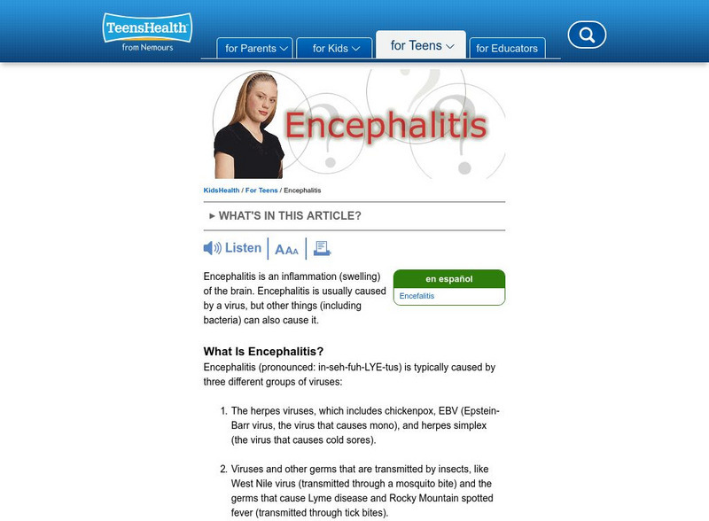 Kids Health:teens: Encephalitis Handout Kids Health:teens: Encephalitis Handout