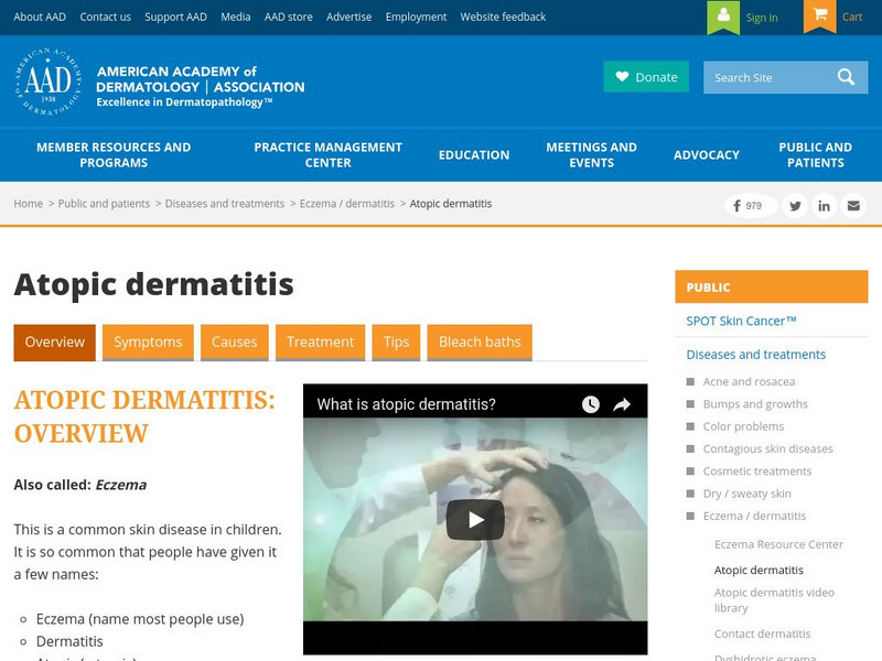 American Academy of Dermatology: Atopic Dermatitis Website