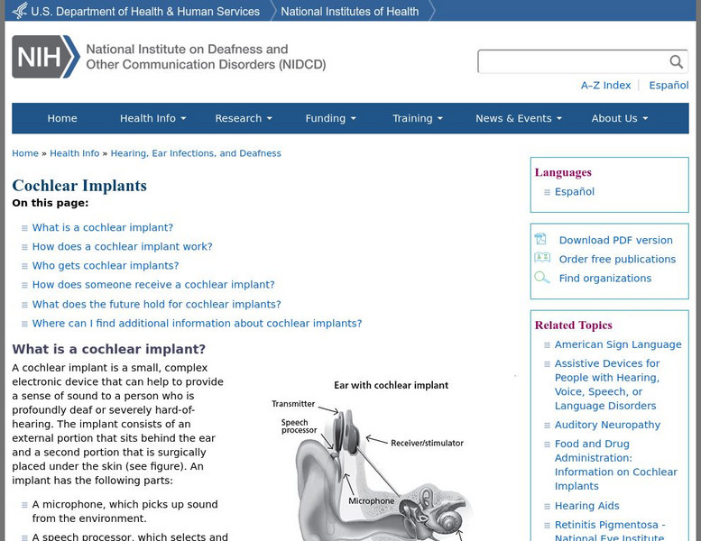 Nidcd: Cochlear Implants Handout Nidcd: Cochlear Implants Handout