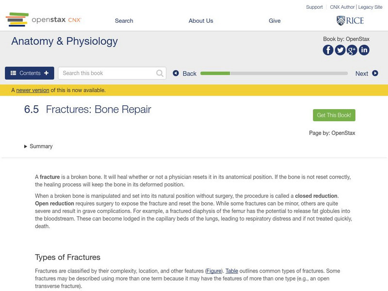 Open Stax: Fractures and Bone Repair Unit Plan Open Stax: Fractures and Bone Repair Unit Plan