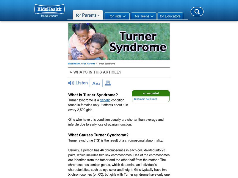 Kids Health: Turner Syndrome Article Kids Health: Turner Syndrome Article