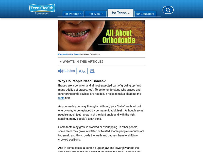 Kids Health: All About Orthodontia Article Kids Health: All About Orthodontia Article