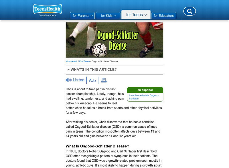 Kids Health: Osgood Schlatter Disease Article Kids Health: Osgood Schlatter Disease Article