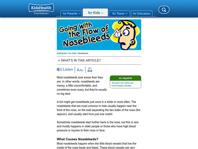 Kids Health: Going With the Flow of Nosebleeds Article Kids Health: Going With the Flow of Nosebleeds Article