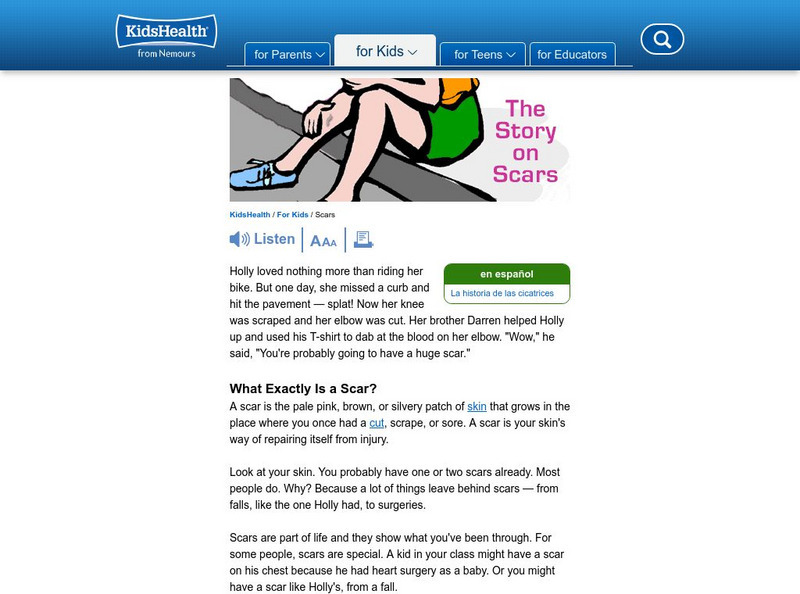 Kids Health: The Story on Scars Article Kids Health: The Story on Scars Article