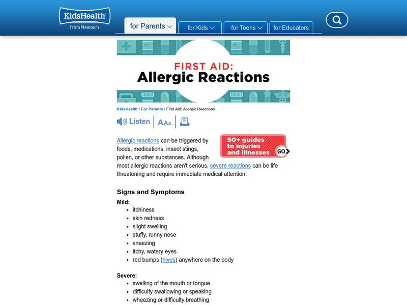 Kids Health: Allergic Reactions Article Kids Health: Allergic Reactions Article