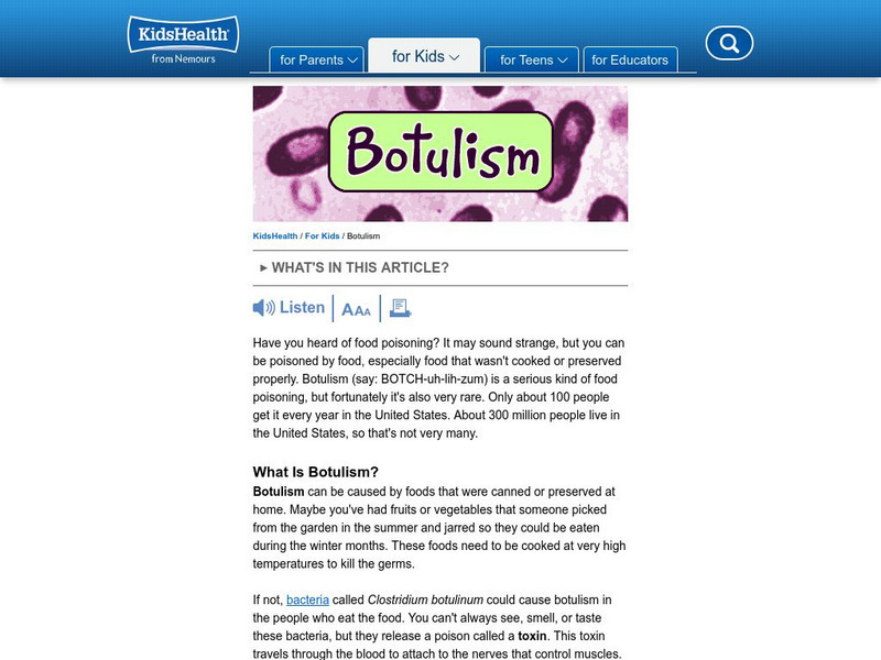Kids Health: Botulism Article Kids Health: Botulism Article