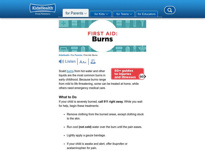 Kids Health: Burns Instruction Sheet Article Kids Health: Burns Instruction Sheet Article