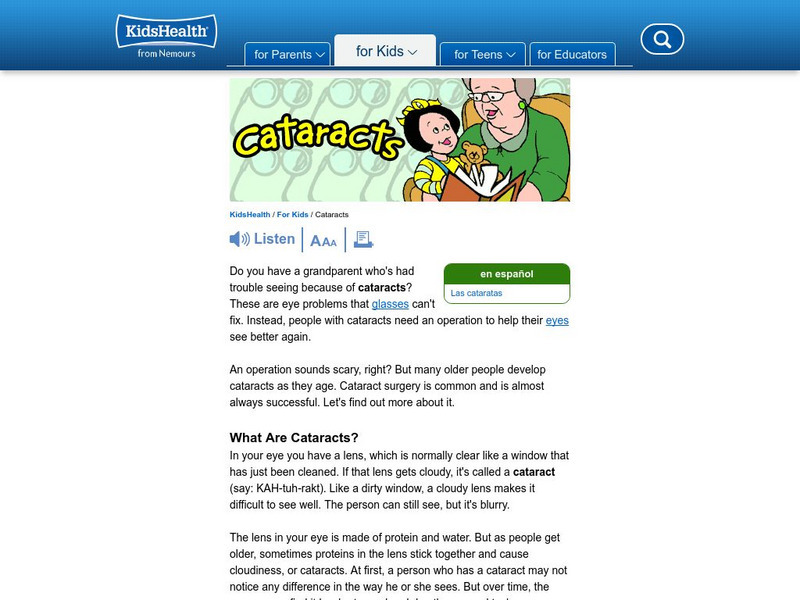 Kids Health: Cataracts Article Kids Health: Cataracts Article