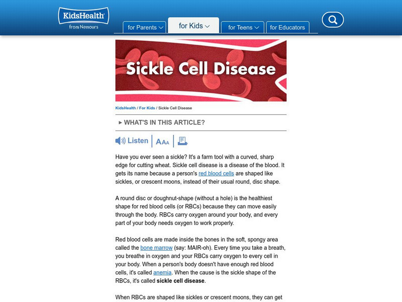 Kids Health: Do You Know About Sickle Cell Anemia? Article Kids Health: Do You Know About Sickle Cell Anemia? Article