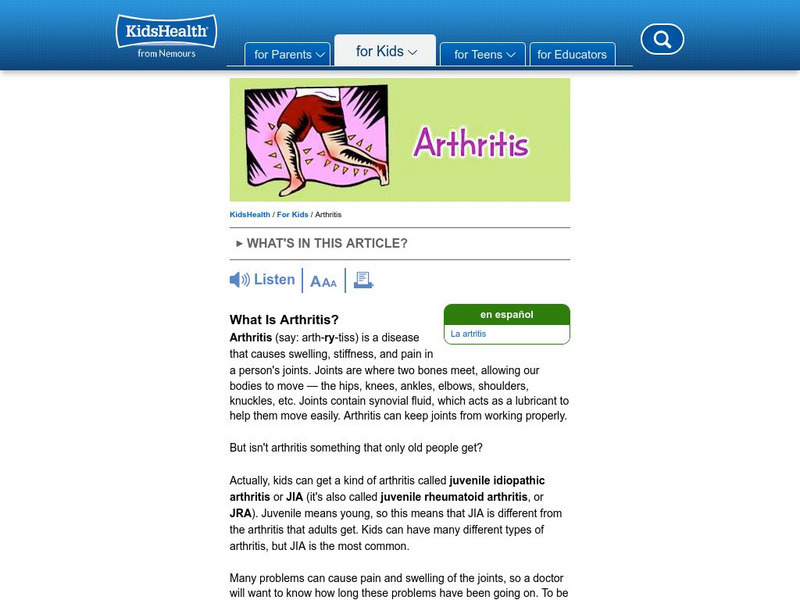 Kids Health: Juvenile Rheumatoid Arthritis Article Kids Health: Juvenile Rheumatoid Arthritis Article
