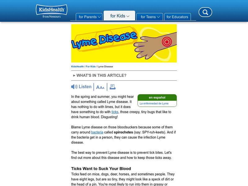 Kids Health: Lyme Disease Article Kids Health: Lyme Disease Article
