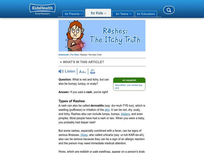 Kids Health: Rashes: The Itchy Truth Article Kids Health: Rashes: The Itchy Truth Article