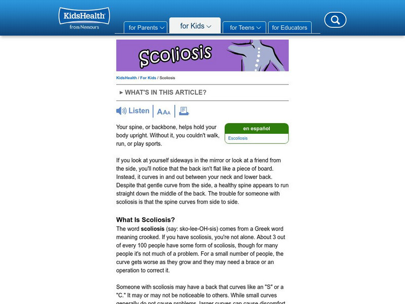 Kids Health: Scoliosis Article Kids Health: Scoliosis Article