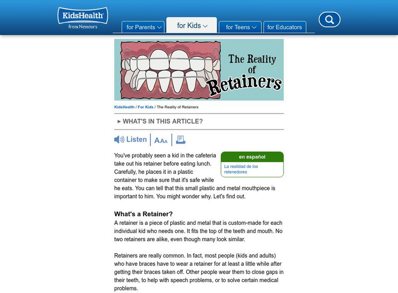 Kids Health: The Reality of Retainers Article Kids Health: The Reality of Retainers Article