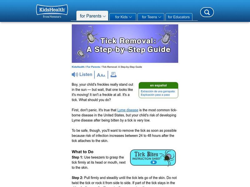 Kids Health: Tick Removal: A Step by Step Guide Article Kids Health: Tick Removal: A Step by Step Guide Article